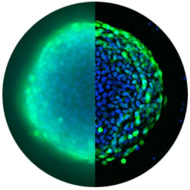 Image Imaging Widefield Confocal Comparison